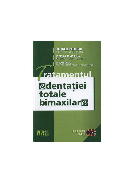 Copertă produs Tratamentul edentaţiei totale bimaxilare - gallery big 1