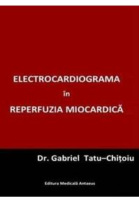 Copertă produs Electrocardiograma în reperfuzia miocardică