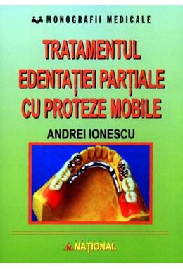 Copertă produs Tratamentul edentației parțiale cu proteze mobile