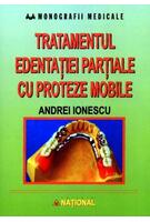 Imagine produs Tratamentul edentației parțiale cu proteze mobile