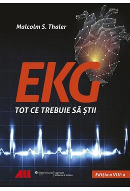 Copertă produs EKG - Tot ce trebuie să știi