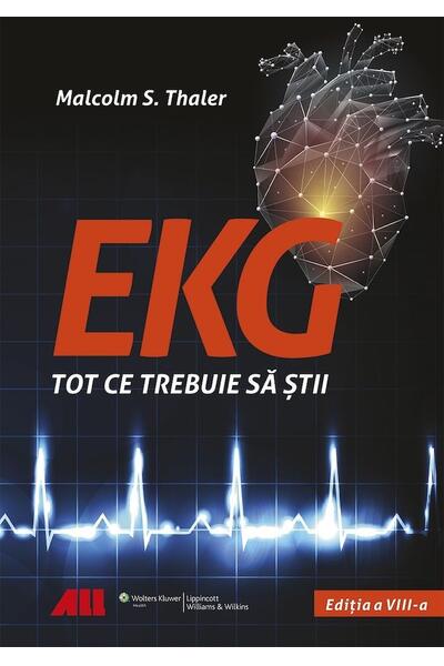 EKG - Tot ce trebuie să știi