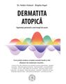 Copertă produs Dermatita atopică. Experiența personală a unei terapii de succes - thumb 1