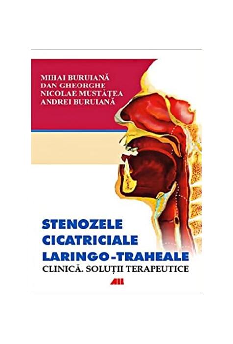 Copertă produs Stenozele cicatriciale laringo-traheale