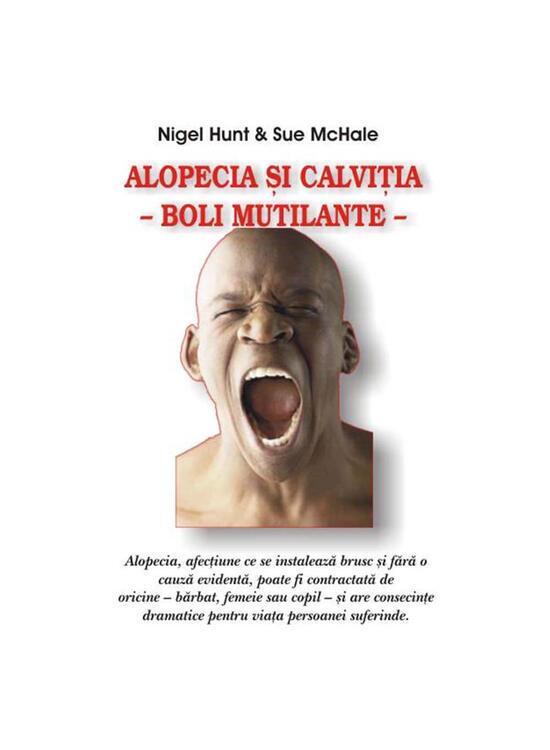 Copertă produs Alopecia şi calviţia - gallery big 1