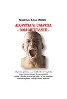 Imagine produs Alopecia şi calviţia