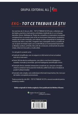 Copertă produs EKG - Tot ce trebuie să știi
