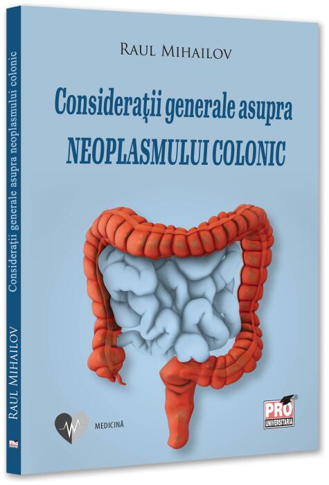 Copertă produs Considerații generale asupra neoplasmului colonic