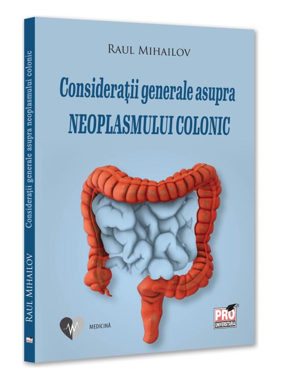 Copertă produs Considerații generale asupra neoplasmului colonic - gallery big 1