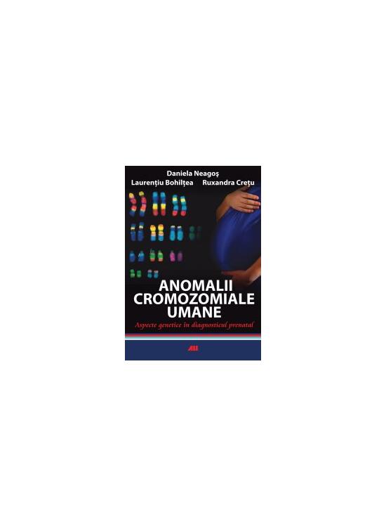 Copertă produs Anomalii cromozomiale umane. Aspecte genetice &icirc;n diagnosticul prenatal - gallery big 1