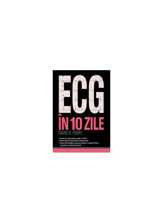Copertă produs ECG &icirc;n 10 zile - gallery big 1