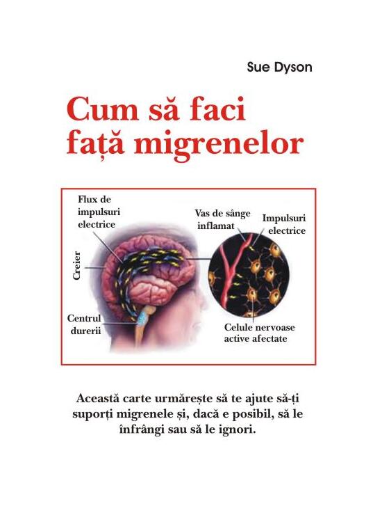 Copertă produs Cum să faci faţă migrenelor - gallery big 1