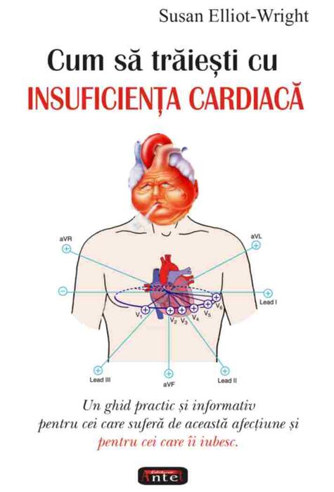 Copertă produs Cum să trăieşti cu insuficienţa cardiacă
