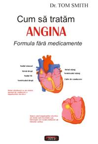Copertă produs Cum să tratăm angina