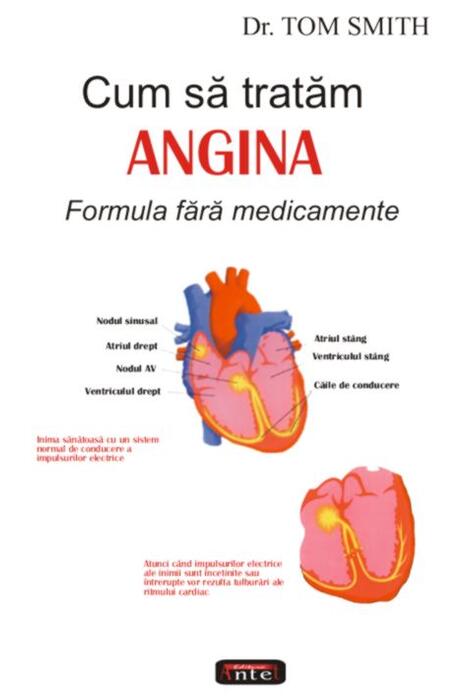 Copertă produs Cum să tratăm angina
