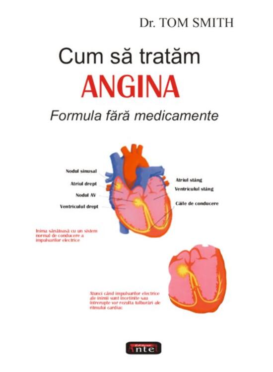 Copertă produs Cum să tratăm angina - gallery big 1