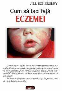 Copertă produs Cum să faci faţă eczemei