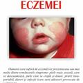 Copertă produs Cum să faci faţă eczemei - gallery small 